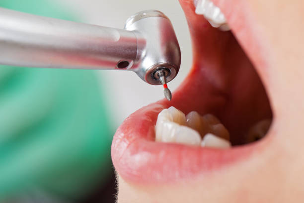 Best Pediatric Emergency Dentist in Maple Park, IL